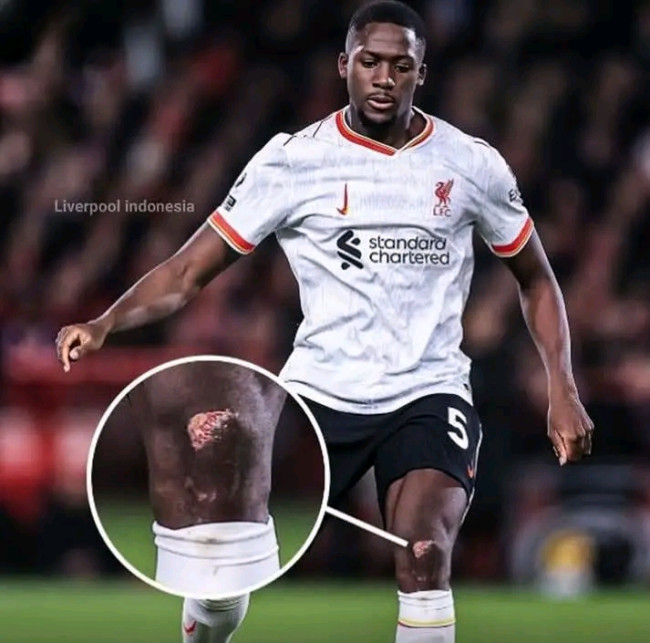 "Rela Mati Demi Liverpool: Pengakuan Mengharukan Ibrahima Konaté" 5 IMG 20250128 183824